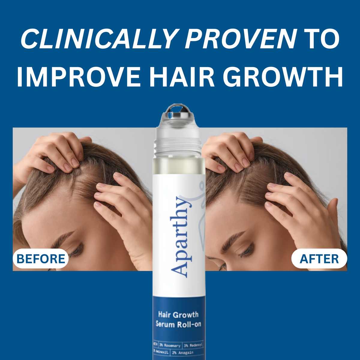 AZEMORA Hair Growth Roll-On Serum — product view 5