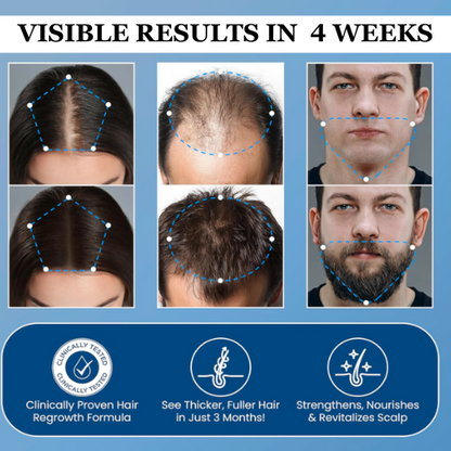 AZEMORA Hair Growth Roll-On Serum — product view 6