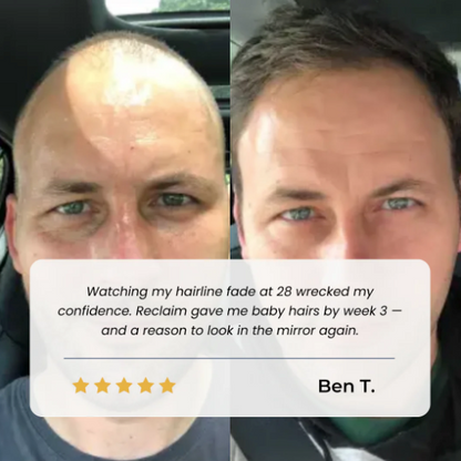 AZEMORA Hair Growth Roll-On Serum — product view 7
